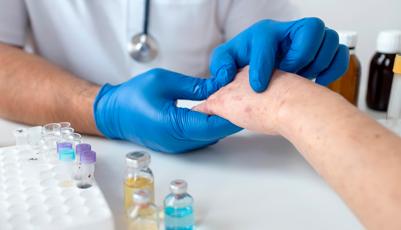 Doctor examining an allergic skin reaction allergy