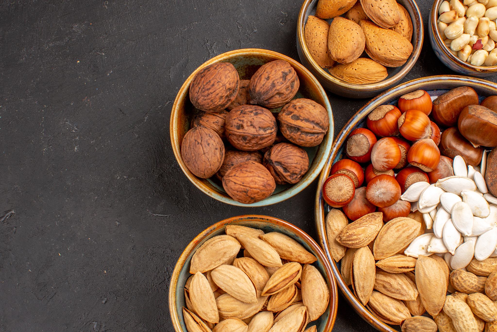 FOOD ALLERGIES NUTS